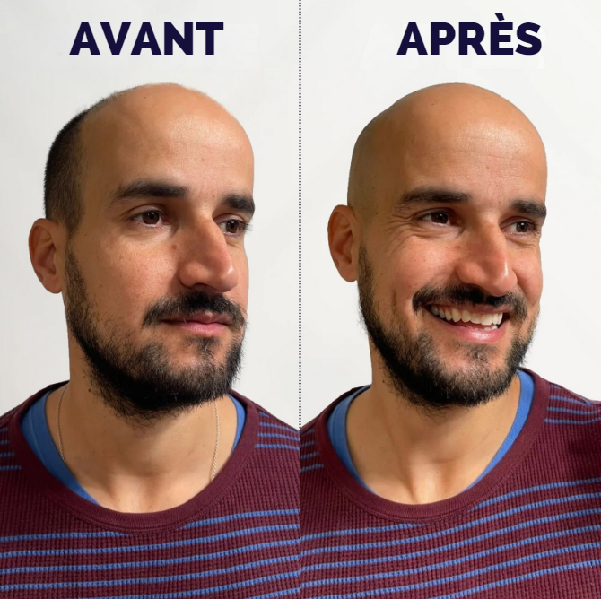 Kit de rasage SmoothGlide®